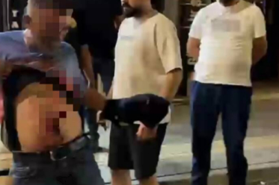 Aksaray’da Kavga: Bir Kişi Karnından Bıçaklandı